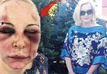 Россиянка приехала к мужчине в Турцию и сбежала через два дня избиений