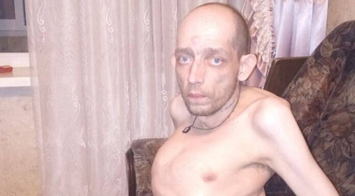 В Подмосковье умер заключенный «с вывернутыми суставами», которого удалось освободить из тюрьмы